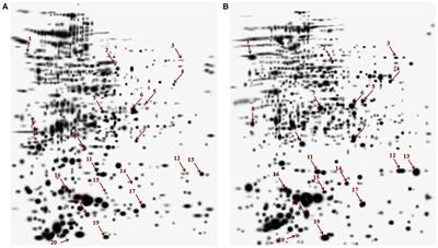 Cytosolic Proteome Profiling of Aminoglycosides Resistant Mycobacterium tuberculosis Clinical Isolates Using MALDI-TOF/MS